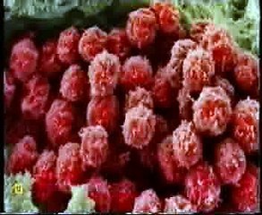 La peste negra: Nostradamus (Historia de la Medicina)