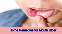 मुहं के छालों के घरेलू उपचार । Home remedies for Mouth Ulcers