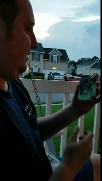 Elle apprend à son mari qu'elle va lui donner un rein ! Don d'organe