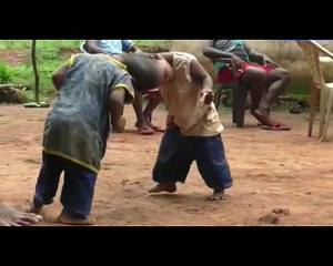 Conjoined two-year-old twins Honey and Singh fused at cranium