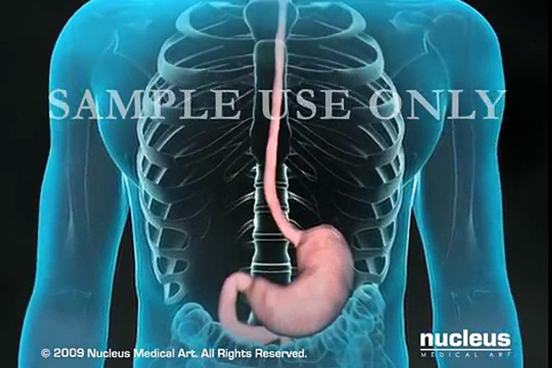 ENDOSCOPIA DEL TRACTO GASTROINTESTINAL SUPERIOR