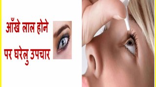 How to cure Eye redness in Hindi//आँखों की लालिमा (लाल आँखे) का घरेलू उपचार