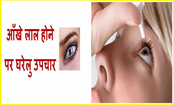 How to cure Eye redness in Hindi//आँखों की लालिमा (लाल आँखे) का घरेलू उपचार