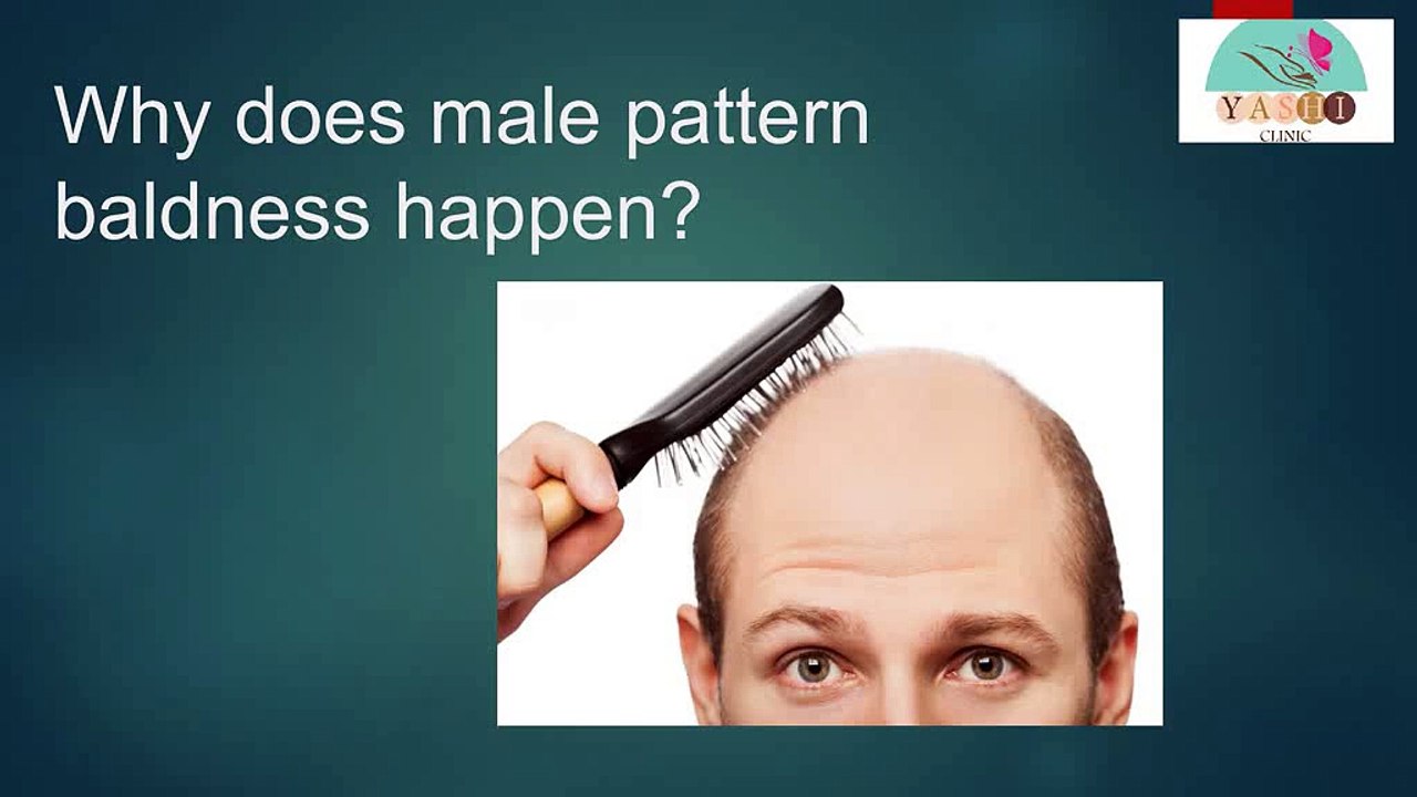 Why does male pattern baldness happen