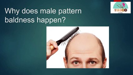 Why does male pattern baldness happen