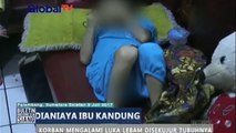 Balita Alami Luka Lebam Diduga Dianiaya Ibu Kandung