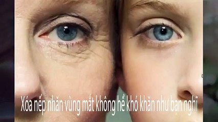 3 buoc xoa nep nhan vung mat hieu qua don gian ngay tai nha - YouTube