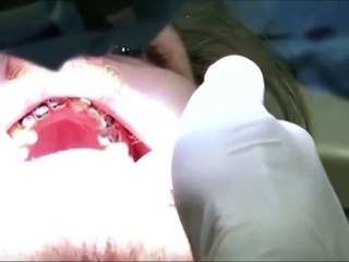 Il ne s'est pas lavé les dent depuis 20 ans... L'état de sa bouche est catastrophique