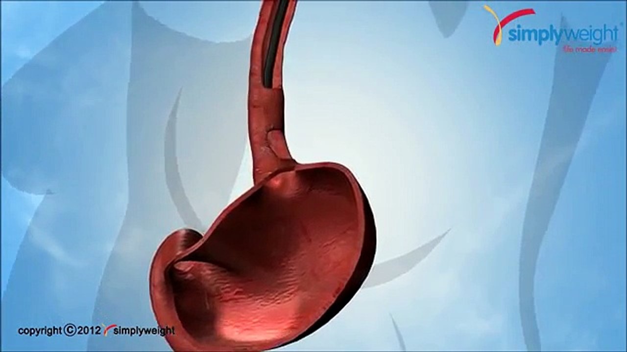 só sánh máy tập bụng với bonng bóng dạ dày giảm cân