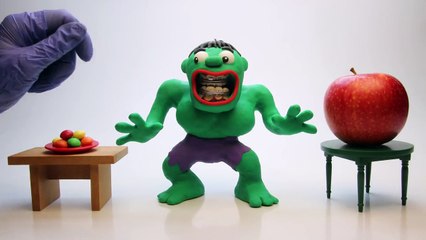 Hulk Gets Braces superhero