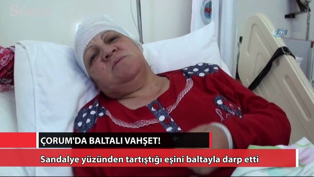 Sandalye yüzünden tartıştığı eşini baltayla darp etti