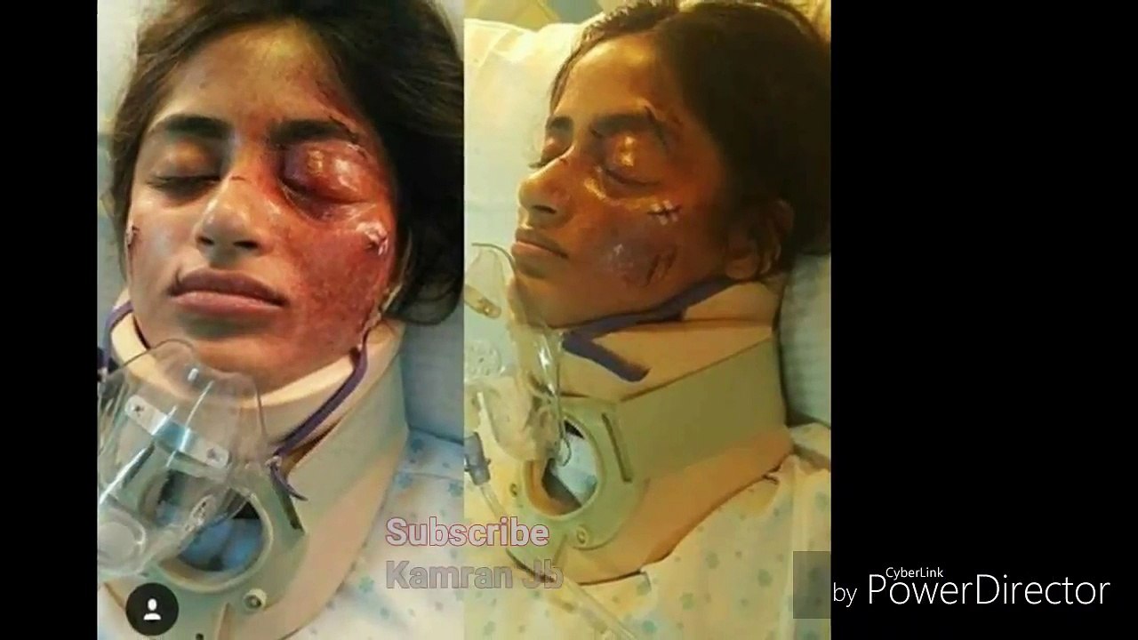 Sajal Ali accident Pic 2017 and follow my channel