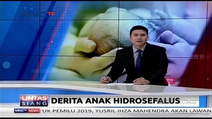 Derita Anak Hidrosefalus, Ibu Berjualan Keripik di SPBU