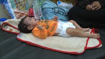 هذا الصباح-الكوليرا وباء من الماضي يطل برأسه باليمن