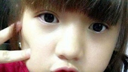 Cải thiện đôi mắt không đều nhờ nhấn mí Hàn Quốc