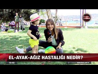Çocuklarda el-ayak-ağız hastalığı! - 12 temmuz 2017