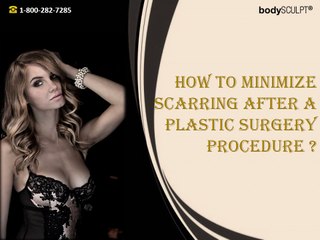 How to Minimize Scarring after a Plastic Surgery Procedure