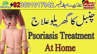 Psoriasis Treatment At Home || Chanbal Ka Garelu Ilaj