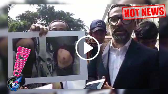 Hot News! Hasil Visum Putra Jeremy Thomas Sungguh Mengejutkan - Cumicam 17 Juli 2017