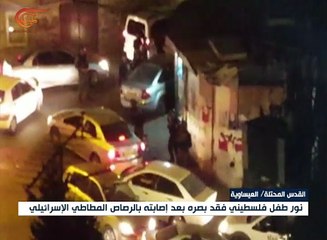 نور حمدان طفل مقدسي يفقد البصر نتيجة إصابته برصاص ...
