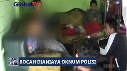 Bocah Korban Penganiayaan Oknum Polisi Belum Bisa Masuk Sekolah