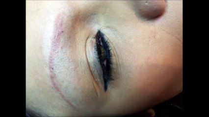 Skin Care Matters by Susan Thrush - (303) 323-4836