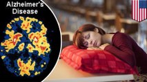 Kurang tidur malam dapat menyebabkan Alzheimer - Tomonews