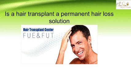 Is a hair transplant a permanent hair loss solution