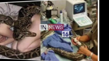 हर रात अजगर महिला से  लिपट कर सोता था ,जब डॉक्टर ने सच्चाइ बताई तोह उड़ गए होश