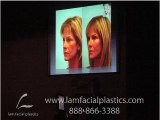 FACE LIFT ALTERNATIVE WITH FAT GRAFTING IN ST.LOUIS 2