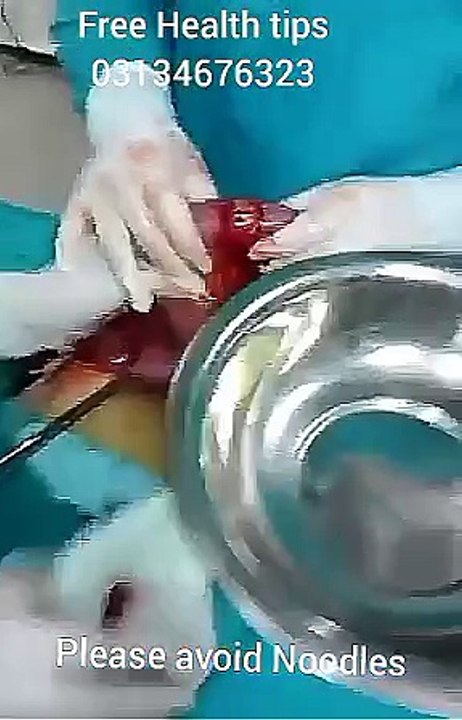 VID-20170707-WA0003