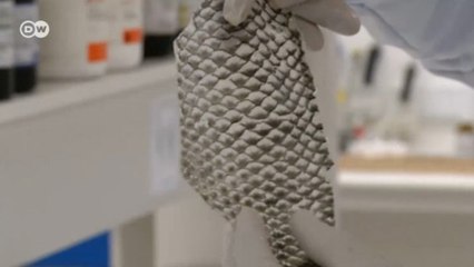 Çupra derisiyle yanık tedavisi