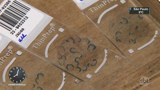 Exame mal realizado compromete diagnóstico de câncer de colo do útero