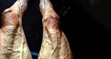 Fransa Bisiklet Turu'nda Polonyalı Sporcunun Bacakları Şaşkına Çevirdi