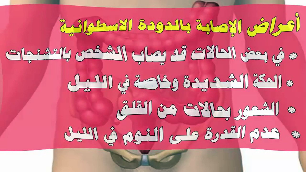 أعرض يجب أن تعلمها عن دودة البطن