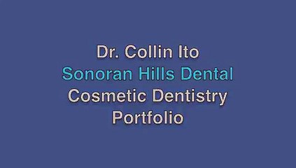 Sonoran Hills Dental Cosmetic Dentistry Portfolio