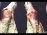 Así lucen piernas de un ciclista tras el Tour de Francia | Noticias con Yuriria Sierra