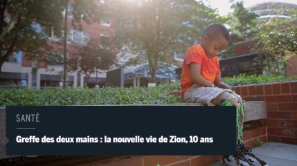 Greffe des deux mains : la nouvelle vie d'un petit garçon de 10 ans