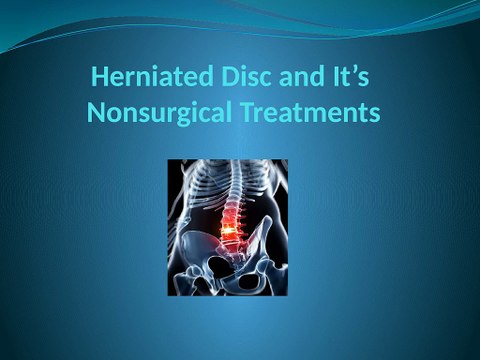 Symptoms of Herniated Disc and Treatment - AyurMana Review