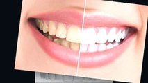 Burnaby Square Dental - burnaby dentist - dental implants burnaby
