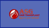 Hair transplant surgery in India