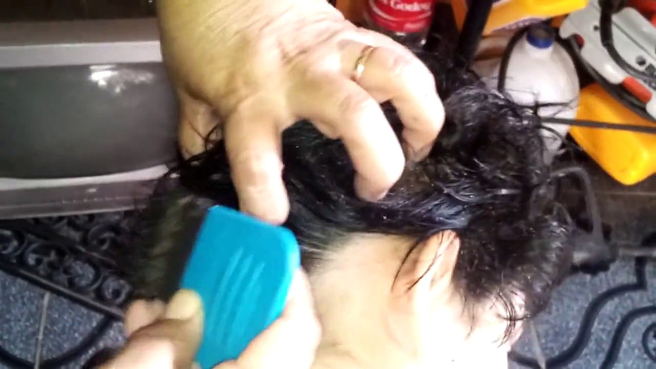 Ce gamin a la tête infestée de poux... Des milliers, qui grouillent dans ses cheveux