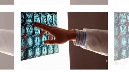 Hire a skilled Brain Injury Lawyer to eligible for Compensation