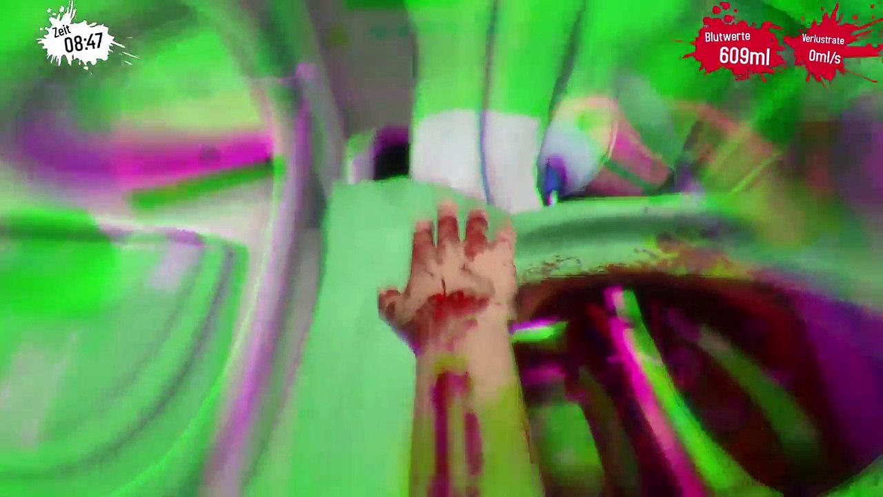 .                                  _ (32)