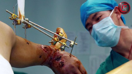 Interventi medici incredibili