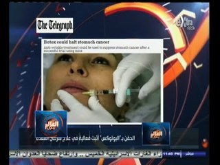 #العالم_يقول | الحلقة الكاملة 21 أغسطس 2014 | الحقن بالبوتوكس اثبت فاعلية في علاج سرطان المعدة