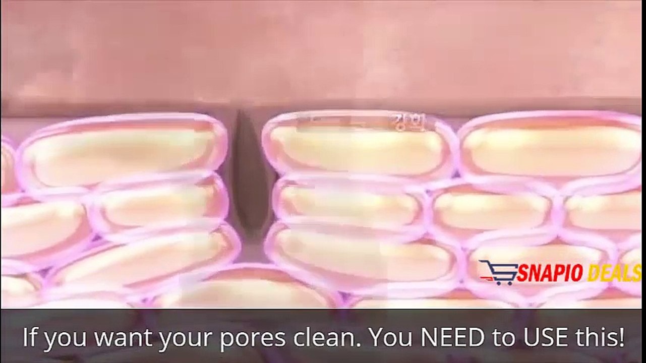 100% Original Black Mask blackhead removal