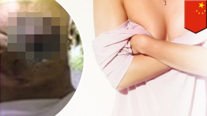 Woman discovers her botched boob job was done by a dentist