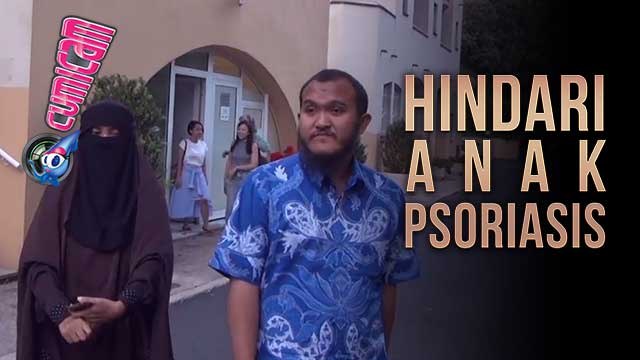 Sembuh dari Psoriasis, Indadari Cegah Anak Menderita yang Sama - Cumicam 24 Juli 2017