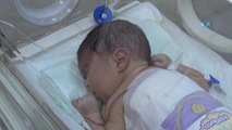 Yüksekova'da İlk Kez Yeni Doğan Bebeğe Omurilik Ameliyatı Yapıldı